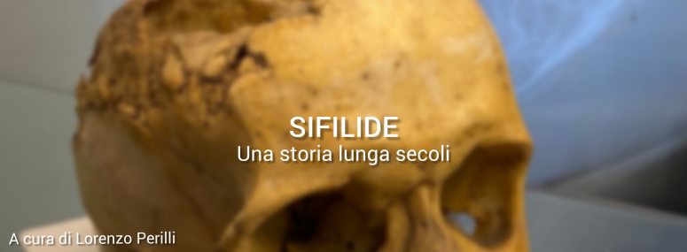 SIFILIDE